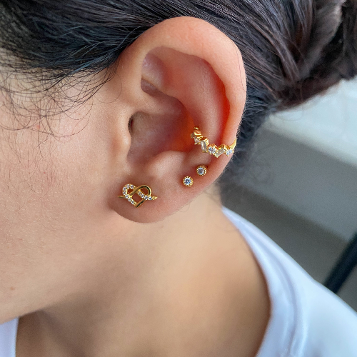 Arete Mich