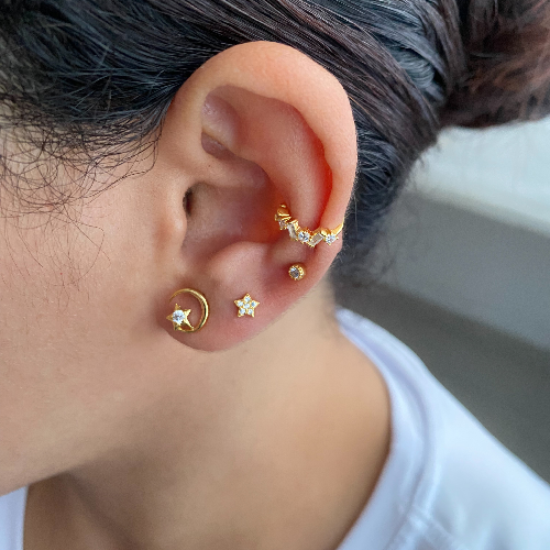 Arete Anelis