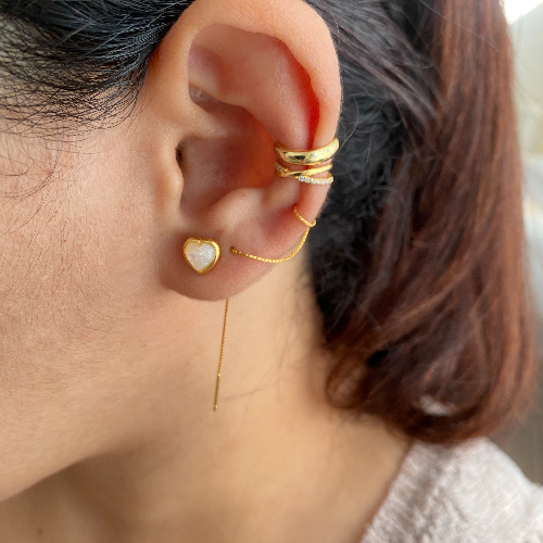 Arete Lott