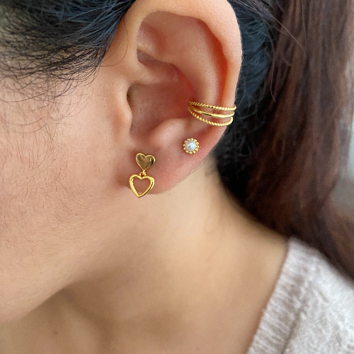 Arete Albani