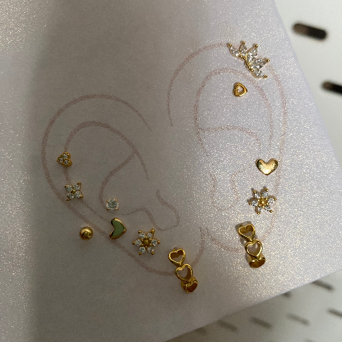 Arete lic